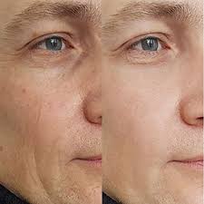 Glutathione